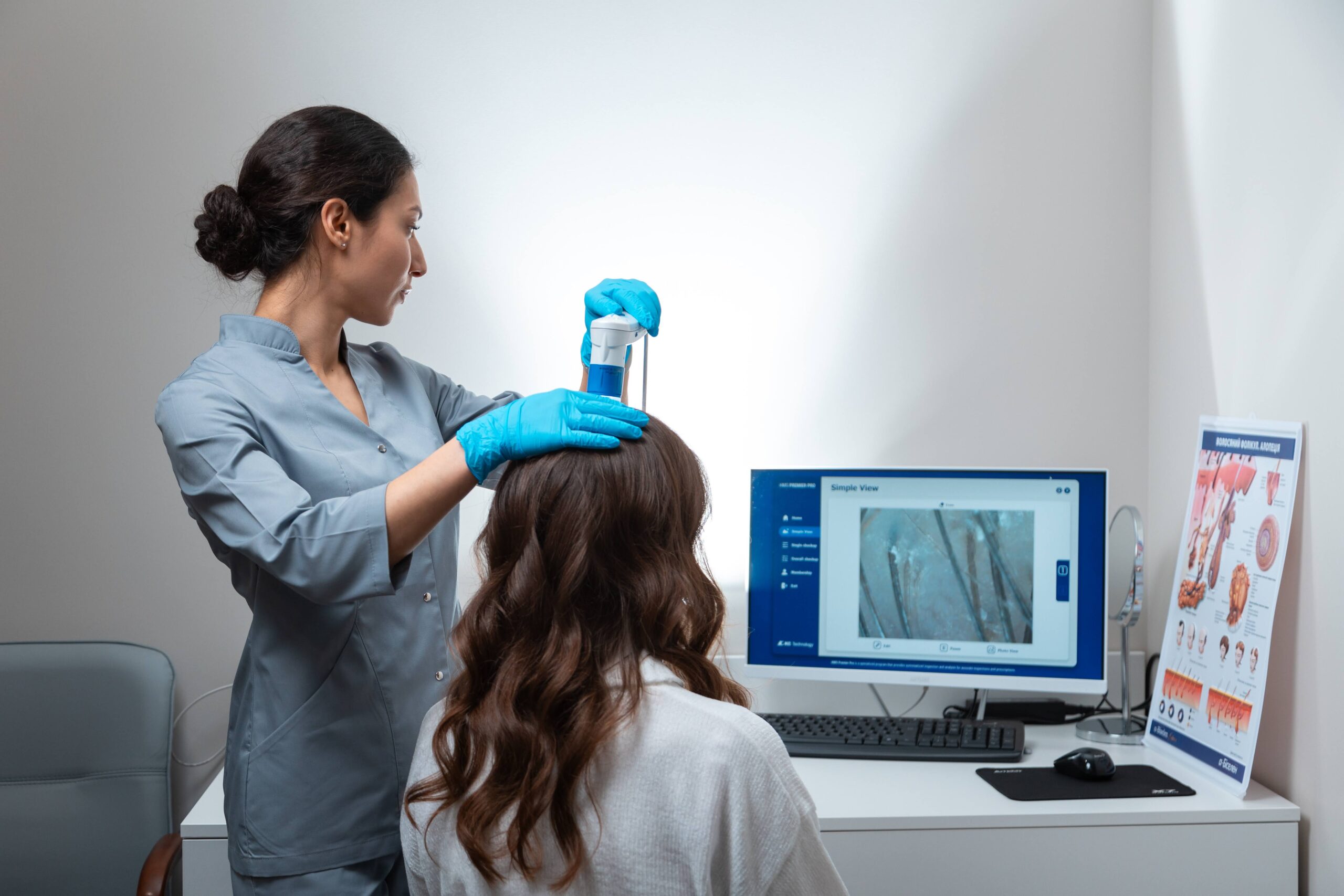 пілінг шкіри голови